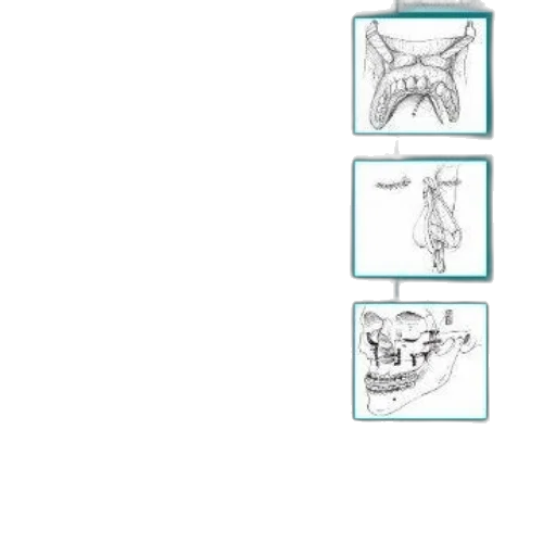 dragon, jewelry, crown, furniture transparent PNG cut-out