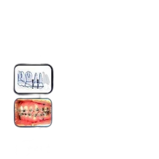 food, crown, jewelry, 3d render transparent PNG cut-out