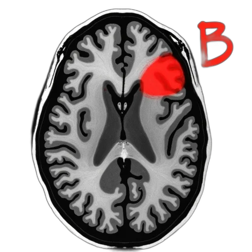 crown, face, red, grayscale transparent PNG cut-out