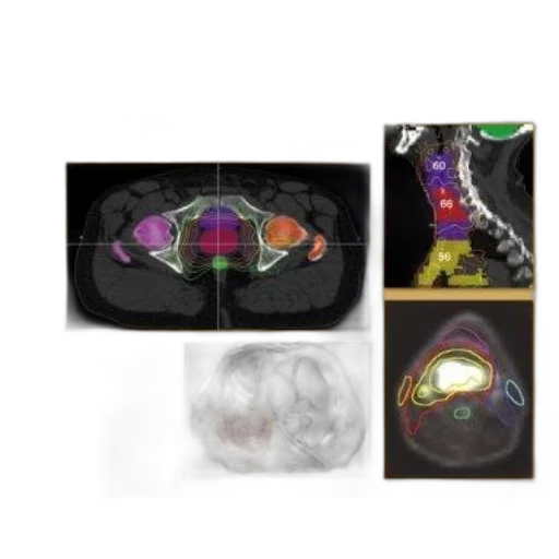 cover, intensity, modulated, radiation transparent PNG cut-out