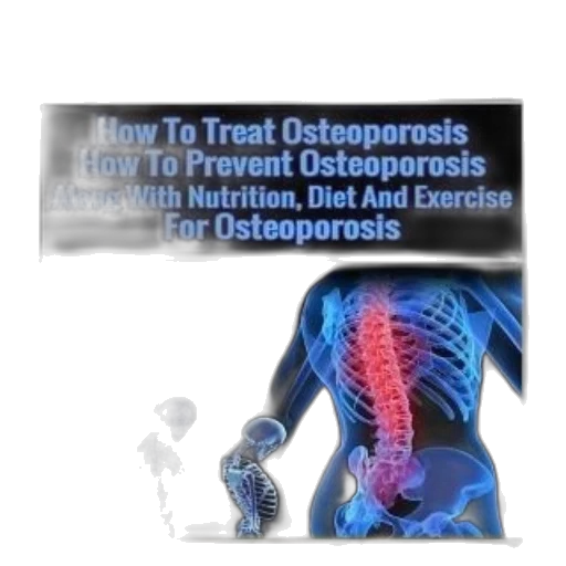 osteoporosis, how, treat, prevent transparent PNG cut-out