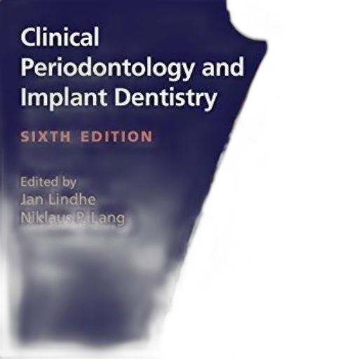 cover, clinical, periodontology, implant transparent PNG cut-out