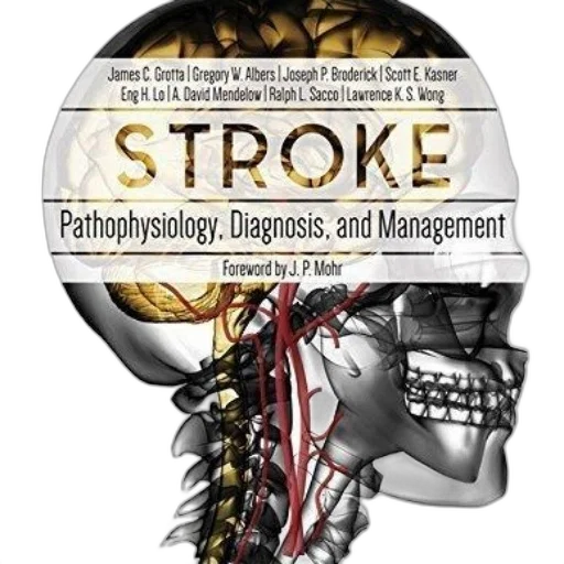 stroke, pathophysiology, diagnosis, management transparent PNG cut-out