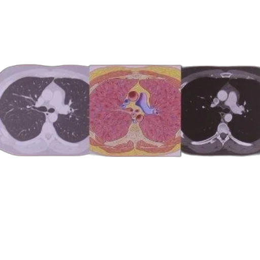 netter, correlative, imaging, cardiothoracic transparent PNG cut-out