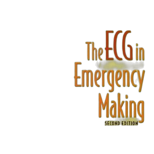 ecg, emergency, decision, making transparent PNG cut-out