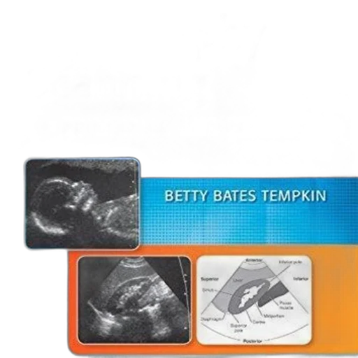 sonography, scanning, principles, protocols transparent PNG cut-out