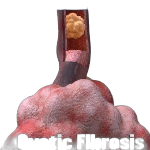 food, medical, illustration, cystic transparent PNG cut-out