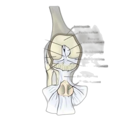 dress, crown, bottle, jewelry transparent PNG cut-out