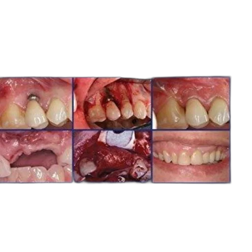 3d render, photorealistic, cover, dental transparent PNG cut-out