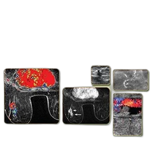 jewelry, clinical, breast, imaging transparent PNG cut-out