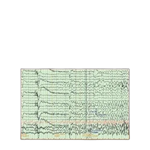 handbook, eeg, interpretation, william transparent PNG cut-out