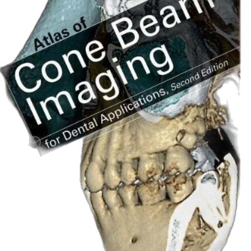 concept art, atlas, cone, beam transparent PNG cut-out