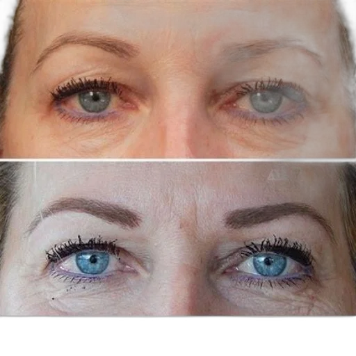 photorealistic, before, after, comparison transparent PNG cut-out