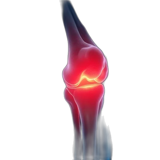 treatment, knee, pain, has transparent PNG cut-out