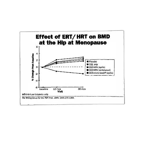 graph, shows, effect, ert transparent PNG cut-out
