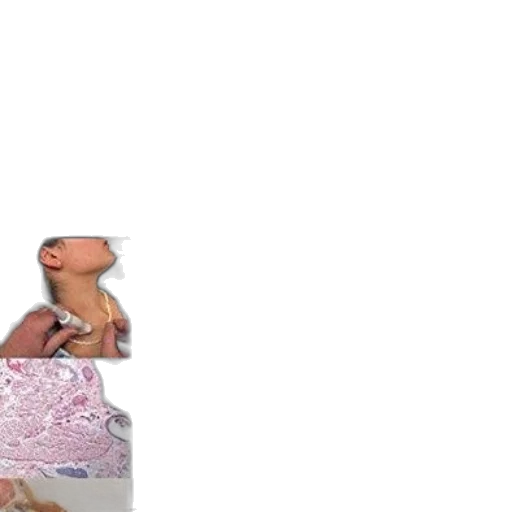 dress, creature, face, hair transparent PNG cut-out