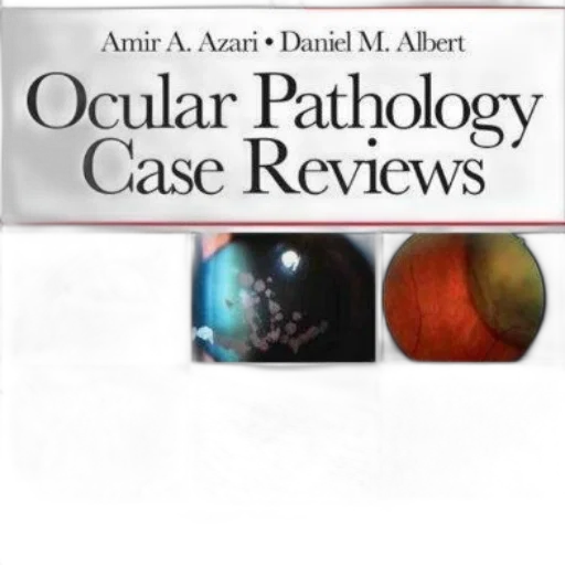 cover, ocular, pathology, case transparent PNG cut-out