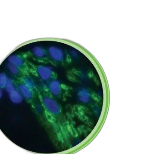 green, cover, culture, cells transparent PNG cut-out