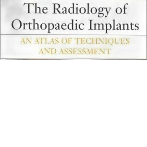radiology, orthopaedic, implants, atlas transparent PNG cut-out