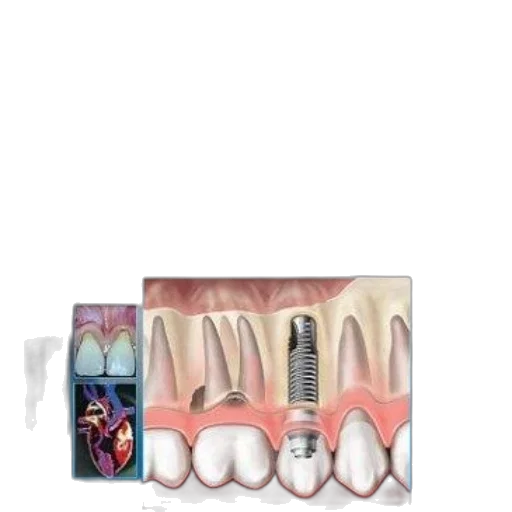 jewelry, pastel, cover, periodontics transparent PNG cut-out