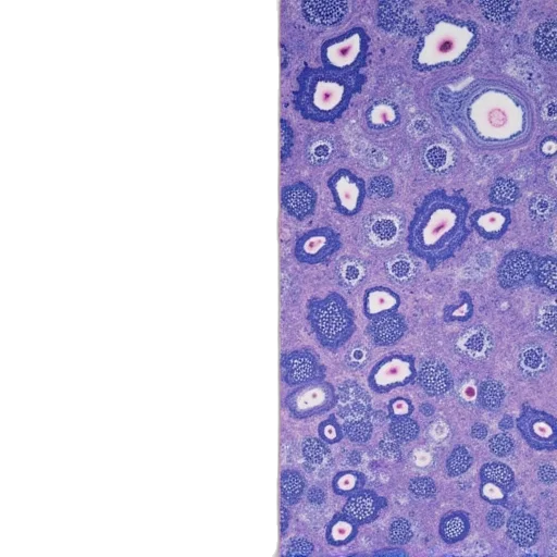 different, pathology, images, two transparent PNG cut-out
