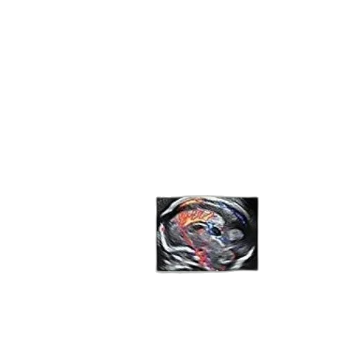 staff, car, jewelry, face transparent PNG cut-out